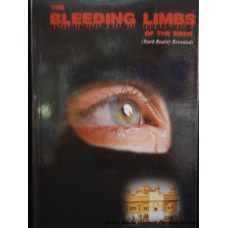 The Bleeding Limbs of the Sikhs
